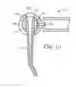 Fig. 07 - Dispensing device for a dental substance