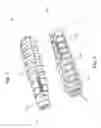 Fig. 03 - Dental securing mechanism with varying thread size