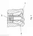 Fig. 05 - Dental securing mechanism with varying thread size