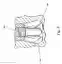 Fig. 05 - Dental abutment with cover