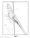 Fig. 10 - Display mounting systems