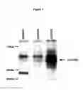 Fig. 02 - Tumor suppressor gene, p47ING3