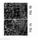 Fig. 02 - Kits for and methods of differential staining of cervical cancer cells and/or tissues
