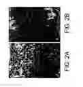 Fig. 03 - Kits for and methods of differential staining of cervical cancer cells and/or tissues