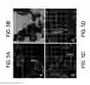 Fig. 06 - Kits for and methods of differential staining of cervical cancer cells and/or tissues
