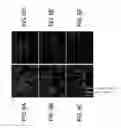 Fig. 07 - Kits for and methods of differential staining of cervical cancer cells and/or tissues