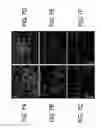 Fig. 08 - Kits for and methods of differential staining of cervical cancer cells and/or tissues