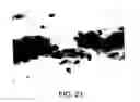 Fig. 22 - Kits for and methods of differential staining of cervical cancer cells and/or tissues