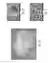 Fig. 02 - USE OF PERFUSION DECELLULARIZED ORGANS FOR MATCHED RECELLULARIZATION