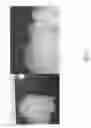 Fig. 03 - USE OF PERFUSION DECELLULARIZED ORGANS FOR MATCHED RECELLULARIZATION