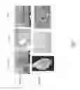 Fig. 06 - USE OF PERFUSION DECELLULARIZED ORGANS FOR MATCHED RECELLULARIZATION