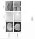 Fig. 07 - USE OF PERFUSION DECELLULARIZED ORGANS FOR MATCHED RECELLULARIZATION