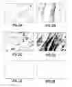 Fig. 03 - Mouse model for pompe disease and methods of use thereof