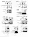 Fig. 04 - Mutations of the parkin gene