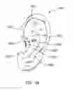 Fig. 45 - Cable assembly with earpiece