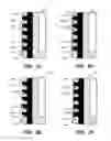 Fig. 04 - Putter heads and putters including polymeric material as part of the ball striking surface