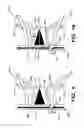 Fig. 11 - Putter heads and putters including polymeric material as part of the ball striking surface