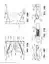 Fig. 14 - Putter heads and putters including polymeric material as part of the ball striking surface