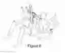 Fig. 06 - ABDOMINAL EXERCISE DEVICE WITH PLUNGER