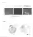 Fig. 03 - Method for detecting and distinguishing intrahepatic cholangiocarcinoma
