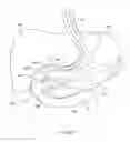 Fig. 331 - Robotic catheter system and methods