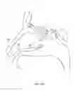 Fig. 366 - Robotic catheter system and methods