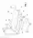 Fig. 02 - Methods, systems, and apparatus for performing minimally invasive coronary artery bypass graft surgery