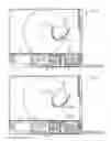Fig. 09 - Navigation system for cardiac therapies