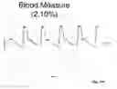 Fig. 69 - DETERMINATION OF BLOOD PUMP SYSTEM PERFORMANCE AND SAMPLE DILUTION USING A PROPERTY OF FLUID BEING TRANSPORTED