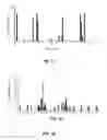 Fig. 09 - Device and method for in vivo detection of clots within circulatory vessels