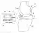 Fig. 01 - System and method for determining patient follow-up subsequent to an orthopaedic procedure