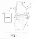 Fig. 02 - System and method for determining patient follow-up subsequent to an orthopaedic procedure