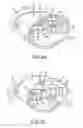 Fig. 06 - Device and method for stimulating the meibomian glands of the eyelid