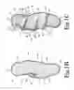 Fig. 03 - Hand held orthosis having a flexible enclosure and method of utilization