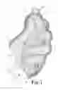 Fig. 07 - Hand held orthosis having a flexible enclosure and method of utilization