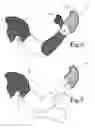 Fig. 08 - Hand held orthosis having a flexible enclosure and method of utilization
