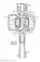 Fig. 04 - Off-axis blood chamber