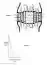 Fig. 02 - Disc shunt delivery with stepped needle