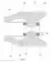 Fig. 07 - EXPANDABLE PYLORIC ANCHORS AND METHODS FOR SECURING INTESTINAL BYPASS SLEEVES