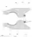 Fig. 08 - EXPANDABLE PYLORIC ANCHORS AND METHODS FOR SECURING INTESTINAL BYPASS SLEEVES