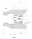 Fig. 20 - EXPANDABLE PYLORIC ANCHORS AND METHODS FOR SECURING INTESTINAL BYPASS SLEEVES