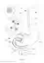 Fig. 32 - EXPANDABLE PYLORIC ANCHORS AND METHODS FOR SECURING INTESTINAL BYPASS SLEEVES