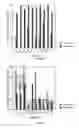 Fig. 03 - Methods of treating vascular lesions