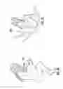 Fig. 10 - DRUG DELIVERY SYSTEM