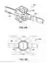 Fig. 06 - Indwelling luminal devices