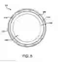 Fig. 07 - Indwelling luminal devices