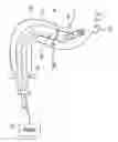 Fig. 01 - Devices and methods for securing tissue