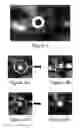 Fig. 03 - Process for folding of drug coated balloon