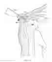 Fig. 08 - Retractable cannula for surgical procedures