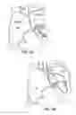 Fig. 06 - Apparatus for safe performance of transseptal technique and placement and positioning of an ablation catheter
